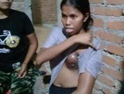 Asnimar 47 Tahun Warga Nagari Gurun Kecamatan Sungai Tarab Menderita Kanker Payudara Yang Akut Kini Butuh Bantuan